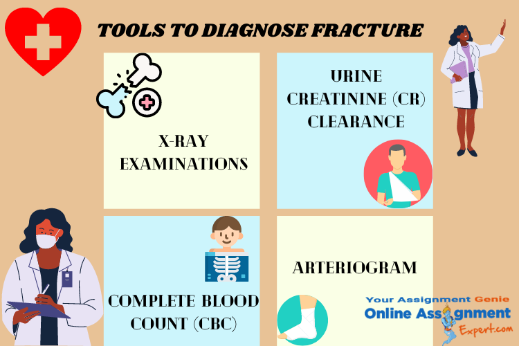 fracture nursing assignment help expert